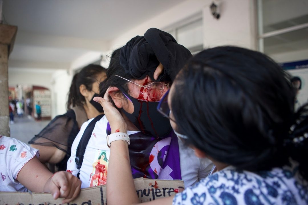 la activista herida