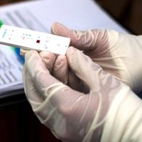 Diagnóstico veloz: cuándo pondrían a la venta el test nacional para detectar el coronavirus