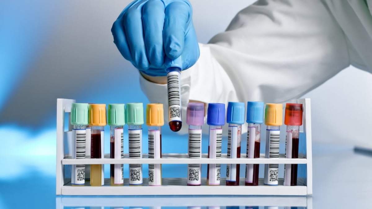 Examen toxicológico. Fuente: (Labdiagnostica)