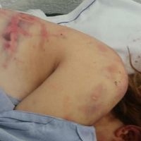 Vinculan a proceso al instructor de karate que golpeó a su novia en Mérida