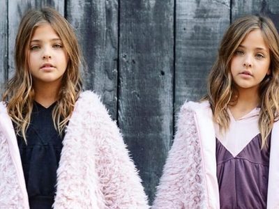 ¡No podrás creerlo! Las gemelas que son furor en la industria de la moda ¡Futuro prometedor!