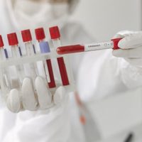 "Diagnóstico de coronavirus": le piden a las obras sociales que cubran los tests