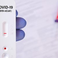 OPS entrega 190 mil pruebas rápidas de covid-19 a cuatro países de América Latina