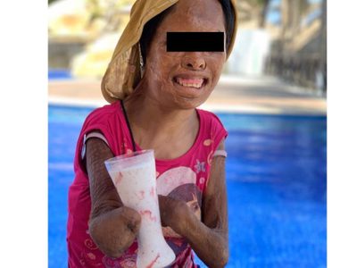 A Juanita, de 12 años, su padre la golpeó, quemó y hasta la vendió