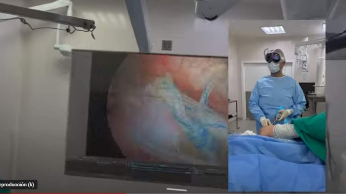 Un cirujano brasileño compartió el video de una artroscopia de hombro
