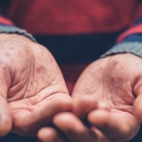 Golpe duro a la salud de los mexicanos: casos de coronavirus y ahora crecen los de sarampión