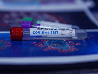 Récord total: un paciente en el Reino Unido dio positivo en coronavirus durante más de 500 días