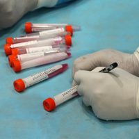 Test de coronavirus: Río Negro deja de hisopar a personas con síntomas leves y contactos estrechos