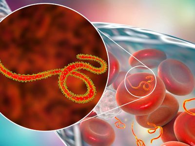 Activan protocolos por ébola en Argentina por embarcaciones provenientes de zonas de riesgo