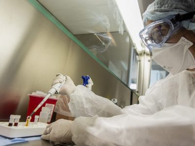 Coronavirus: científicos descubren un posible nuevo síntoma de la enfermedad