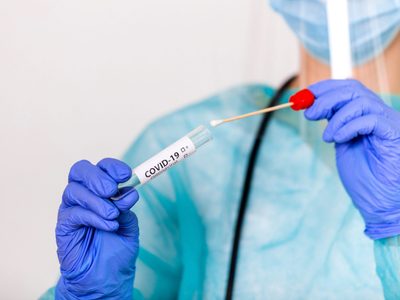 Coronavirus: científicos argentinos desarrollaron una herramienta para detectarlo velozmente