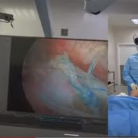 Cirujano realiza una operación usando el Apple Vision Pro y comparte el video