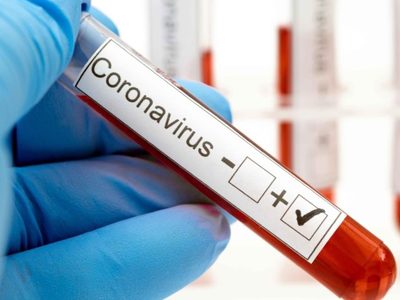 Las 25 localidades neuquinas que cuentan con casos activos de COVID 19