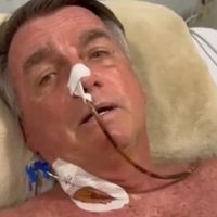 Bolsonaro recibe atención médica por un traumatismo craneoencefálico leve tras caerse en prisión