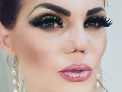 ¿Acierto o error? Las espeluznantes cirugías de los famosos