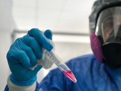 Esta es la prueba que hay que hacerse para saber si se tuvo covid-19