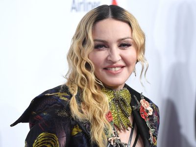 El notable cambio del rostro de Madonna, luego de varios retoques faciales para el olvido