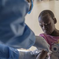OMS autoriza vacuna contra viruela símica para reforzar la respuesta a la enfermedad en África