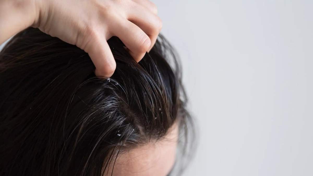 Cabello. Fuente: (X)