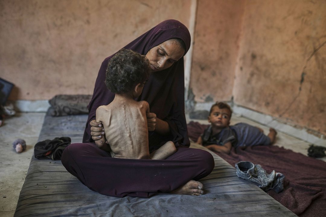 23 de julio. Naima Abu Ful sostiene a su hijo desnutrido de dos años en el campo de refugiados de Shati, en Gaza. Foto APJehad Alshrafi.