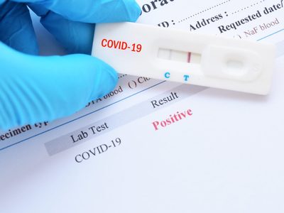 Las farmacias neuquinas venderán test rápidos de coronavirus