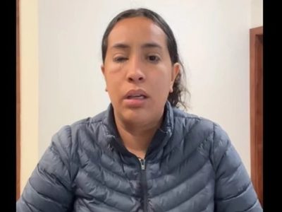 Arrojan ácido a rostro de una mujer emprendedora en Tijuana