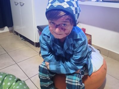 Noah necesita ayuda para tratarse en el Garraham