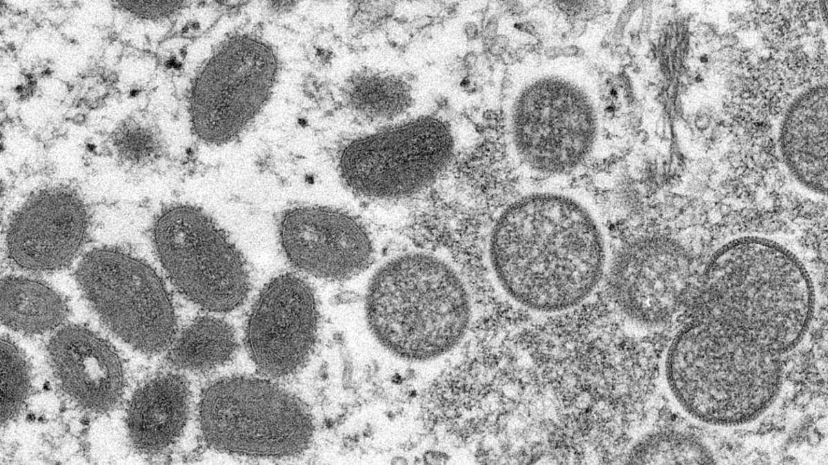 Imagen de microscopio de la viruela del mono, en piel humana