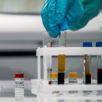 ¿Qué es el efecto Lázaro y cómo funciona en los pacientes con coronavirus?