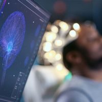 Estudio encuentra relación bidireccional entre enfermedad inflamatoria intestinal y la depresión