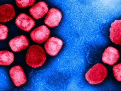 Alemania detecta primer caso de la variante de mpox más letal