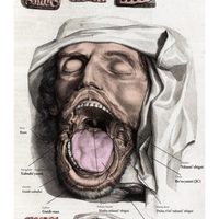 'Láminas del cuerpo humano en zapoteco”, en el IAGO