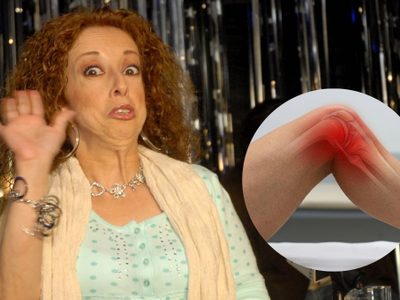 ¿Qué es la hiperlaxitud ligamentaria, la enfermedad incurable que padece María Elena Saldaña desde los 13 años?