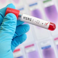La gripe H1N1 podría descender de la cepa que causó la pandemia mortal de 1918