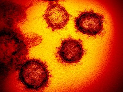 ¡Peligro! Detectan el primer caso de doble infección por coronavirus. ¿Una mutación más infecciosa?