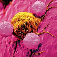 El cáncer ataca a cada vez más personas menores de 50 años en todo el mundo