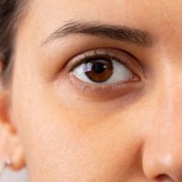 El método más efectivo para eliminar las ojeras en tiempo récord con 1 ingrediente de tu cocina
