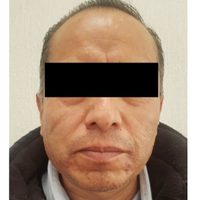 Detienen en Metepec a profesor de kínder acusado de abusar de tres niñas