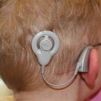 La Corte abre la puerta a que niños del IMSS obtengan implantes cocleares