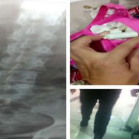 Arrestan en el AICM a una joven que llevaba billetes en el estómago