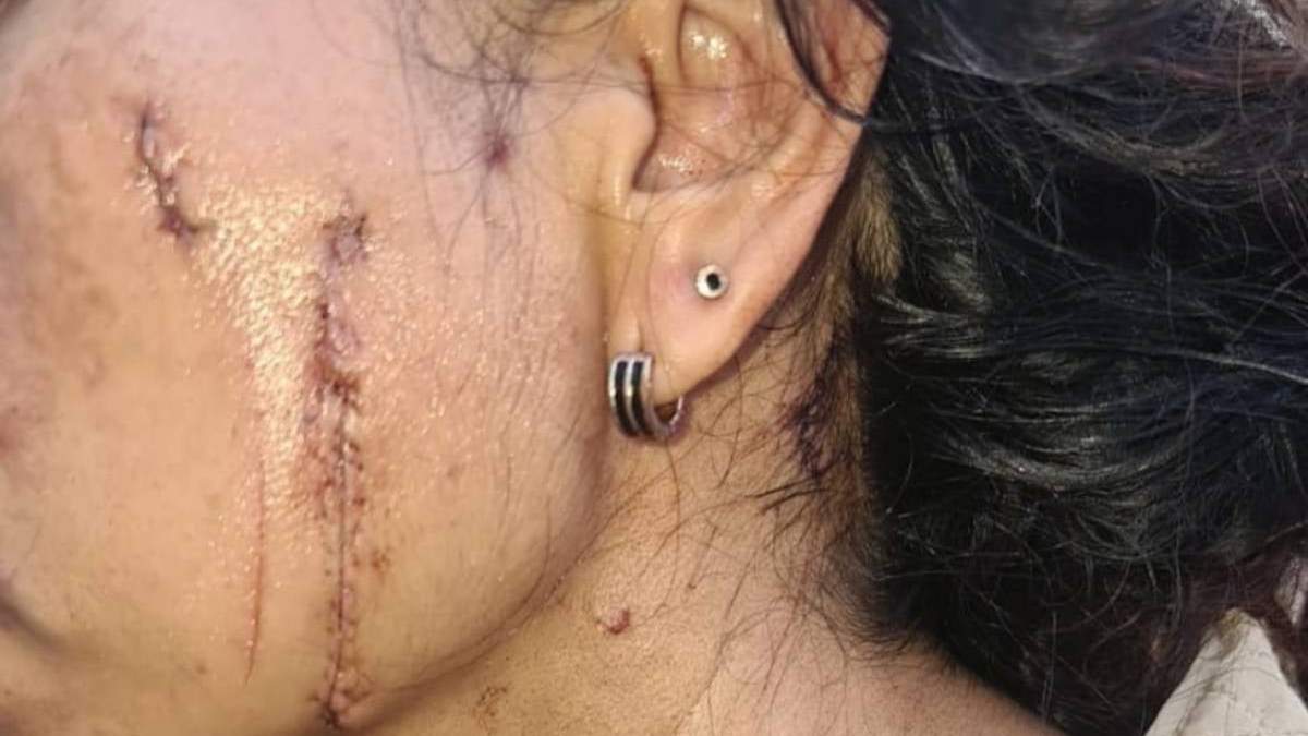 Así quedó la herida de la madre