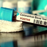 Preocupante: una localidad rionegrina tuvo 5 casos de coronavirus en un día