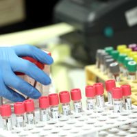 ¡Gran avance! Científicos argentinos crearon un test que detecta al virus del dengue en minutos