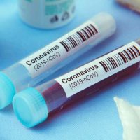 Coronavirus en Río Negro: 13 pacientes fallecidos y 250 nuevos casos