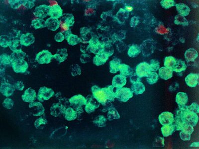 Muere un niño tras infectarse con la ameba "comecerebros"