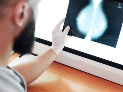 Tratamiento contra cáncer de mama ha cambiado: más curaciones, supervivencia y calidad de vida