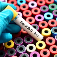 ANMAT aprobó un test de detección rápida para la hepatitis C