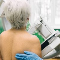 Descubren gen causante de la leucemia linfocítica crónica, presente en más del 80% de los pacientes