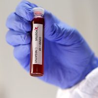 ¿Comienzan los test masivos de coronavirus?