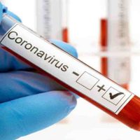 Zapala, muy cerca de alcanzar los 400 casos activos de coronavirus